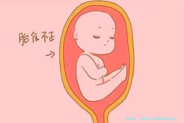 去美国做三代试管医院费用是多少？