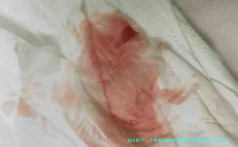 广州排名靠前的试管婴儿医院有哪些？附试管婴儿医院名单分享！